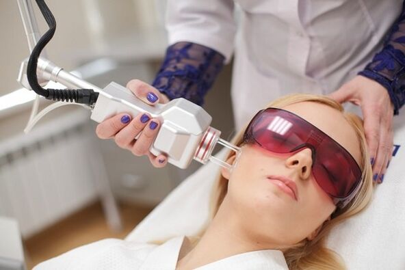 Laser noorendamine näost