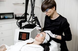 Laser noorendamine