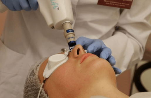 Mitte -võimeline laser noorendamine